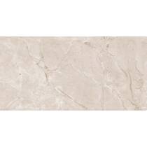 Керамограніт Almera Ceramica-2 British Caramel Expo 60x120 см, фото №4
