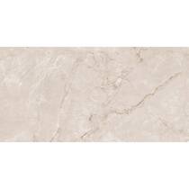 Керамограніт Almera Ceramica-2 British Caramel Expo 60x120 см, фото №2