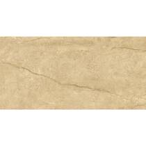 Керамограніт Ceramica Deseo Gres Bergenstone Beige Rect 59,7х119,7 см, фото №6