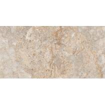 Керамограграніт Almera Ceramica-2 Brescia Gold 79,8x159,8 см, фото №6